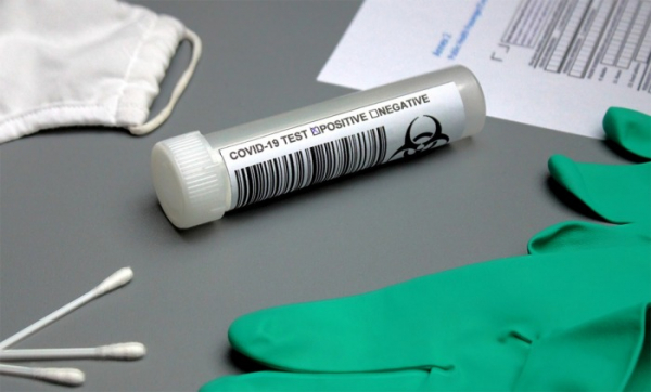 Nemocnice Pardubického kraje spouští antigenní testování pro veřejnost